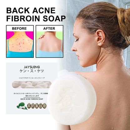 Deep Cleansing, Acne-Treating, and Moisturizing Soap